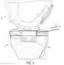 Fig. 10 - System for Articular Surface Replacement