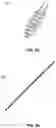 Fig. 25 - System for Articular Surface Replacement