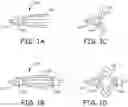 Fig. 02 - Embolectomy devices and methods for treatment of acute ischemic stroke condition