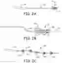 Fig. 03 - Embolectomy devices and methods for treatment of acute ischemic stroke condition