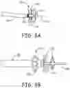 Fig. 04 - Embolectomy devices and methods for treatment of acute ischemic stroke condition