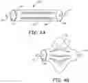 Fig. 05 - Embolectomy devices and methods for treatment of acute ischemic stroke condition