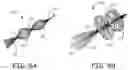 Fig. 06 - Embolectomy devices and methods for treatment of acute ischemic stroke condition