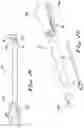 Fig. 04 - APPARATUS AND METHODS FOR PERFORMING MINIMALLY-INVASIVE SURGICAL PROCEDURES