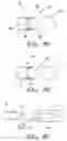 Fig. 17 - APPARATUS AND METHODS FOR PERFORMING MINIMALLY-INVASIVE SURGICAL PROCEDURES