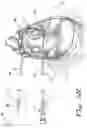 Fig. 22 - APPARATUS AND METHODS FOR PERFORMING MINIMALLY-INVASIVE SURGICAL PROCEDURES