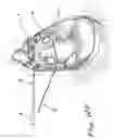 Fig. 23 - APPARATUS AND METHODS FOR PERFORMING MINIMALLY-INVASIVE SURGICAL PROCEDURES