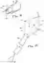 Fig. 25 - APPARATUS AND METHODS FOR PERFORMING MINIMALLY-INVASIVE SURGICAL PROCEDURES