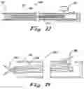 Fig. 35 - APPARATUS AND METHODS FOR PERFORMING MINIMALLY-INVASIVE SURGICAL PROCEDURES