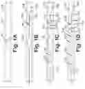 Fig. 02 - Thrombectomy systems and devices and methods of using the same
