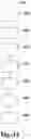 Fig. 12 - Thrombectomy systems and devices and methods of using the same