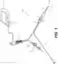 Fig. 02 - Selective tissue removal treatment device