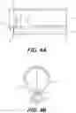 Fig. 04 - Selective tissue removal treatment device
