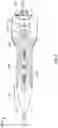 Fig. 03 - Atherectomy devices and methods