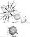 Fig. 05 - Systems and method or uses of ablating cardiac tissue