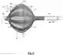 Fig. 06 - Systems and method or uses of ablating cardiac tissue