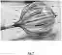 Fig. 08 - Systems and method or uses of ablating cardiac tissue