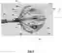 Fig. 09 - Systems and method or uses of ablating cardiac tissue
