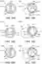Fig. 28 - Treatment mode selection systems and laser catheter systems including same