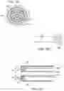 Fig. 05 - System for tissue ablation using pulsed laser