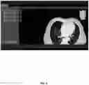 Fig. 06 - Systems and methods for ablation visualization