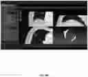 Fig. 10 - Systems and methods for ablation visualization