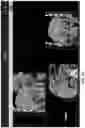 Fig. 14 - Systems and methods for ablation visualization