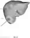 Fig. 15 - Systems and methods for ablation visualization