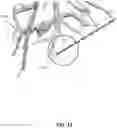 Fig. 16 - Systems and methods for ablation visualization