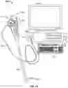 Fig. 02 - Device and method for tracking the position of an endoscope within a patient's body