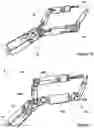 Fig. 03 - Local control robotic surgical devices and related methods