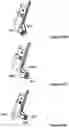 Fig. 49 - Local control robotic surgical devices and related methods