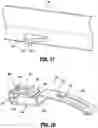 Fig. 13 - Feedback mechanisms for handle assemblies