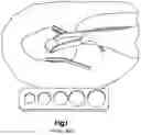Fig. 02 - Surgical instrument handle with implant sizing feature and method of using