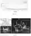Fig. 08 - MAGNETIC RESONANCE IMAGING COMPATIBLE SYSTEM FOR IMPARTING MOTION