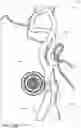 Fig. 17 - Blood vessel sizing device