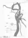 Fig. 23 - Blood vessel sizing device