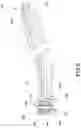 Fig. 03 - Disposable Dental Tool