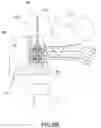 Fig. 08 - Disposable Dental Tool