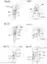 Fig. 04 - ENDODONTIC PIN