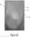 Fig. 02 - Arch adjustment appliance