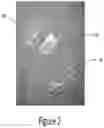 Fig. 04 - Arch adjustment appliance
