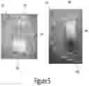 Fig. 07 - Arch adjustment appliance