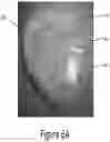 Fig. 08 - Arch adjustment appliance