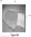 Fig. 09 - Arch adjustment appliance