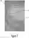 Fig. 10 - Arch adjustment appliance