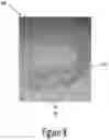 Fig. 11 - Arch adjustment appliance