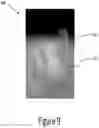 Fig. 12 - Arch adjustment appliance