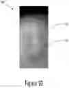 Fig. 13 - Arch adjustment appliance