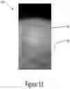 Fig. 14 - Arch adjustment appliance